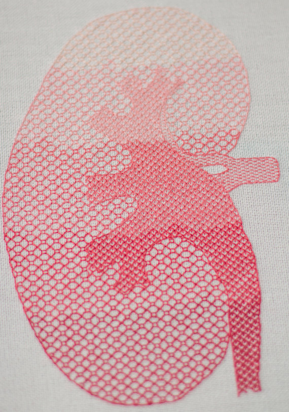 Deviant Discoveries - Geekysqueaky Blackwork kidney by GeekySqueaky